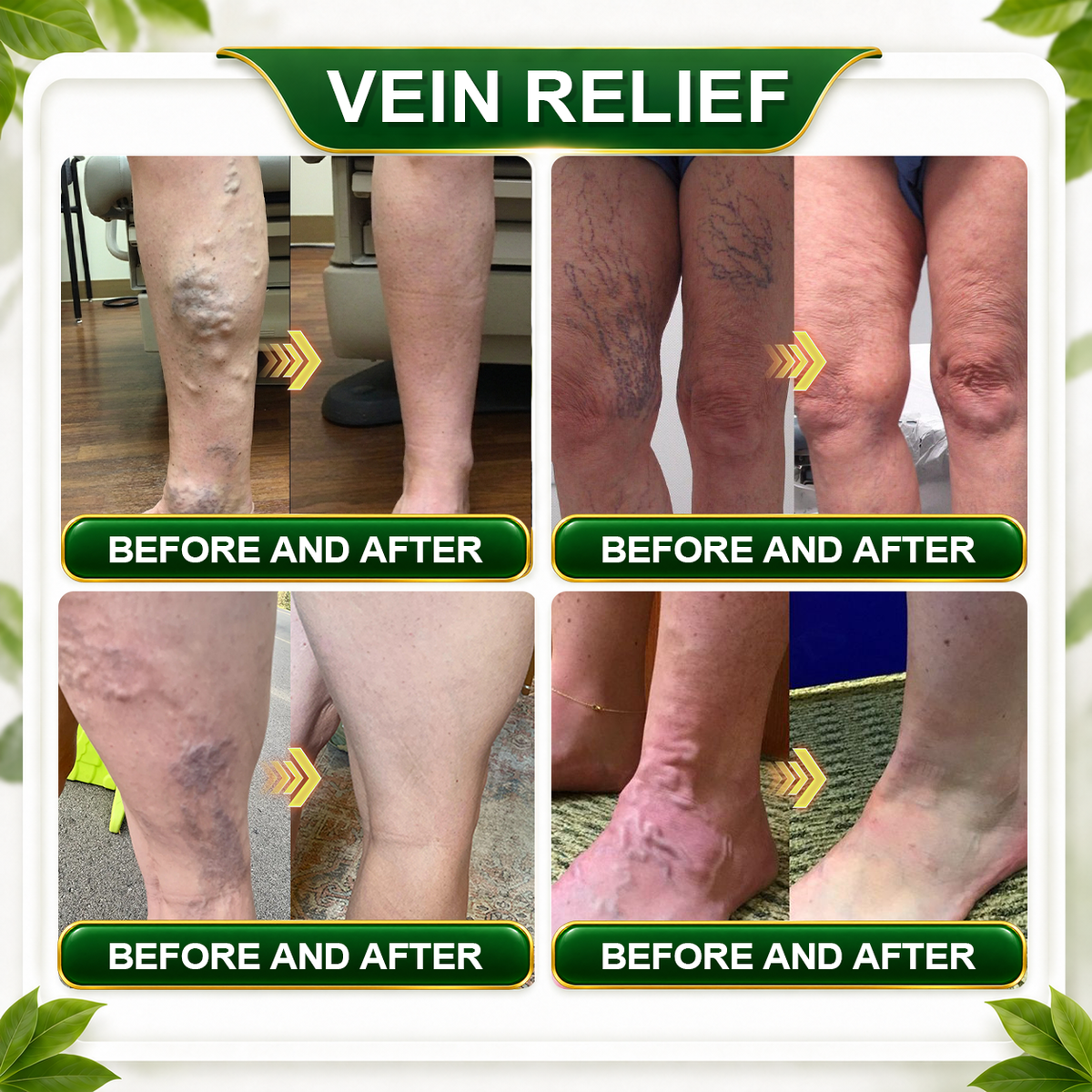 ☘️𝑮𝒓𝒆𝒆𝒏𝑭𝒆𝒆𝒍® 𝑩𝒆𝒓𝒃𝒆𝒓𝒊𝒏𝒆 𝑴𝒐𝒓𝒊𝒏𝒈𝒂- 𝑩𝒆𝒆 𝑽𝒆𝒏𝒐𝒎 𝑫𝒆𝒕𝒐𝒙 𝑺𝒍𝒊𝒎𝒎𝒊𝒏𝒈 𝑭𝒐𝒐𝒕 𝑺𝒐𝒂𝒌 𝑩𝒆𝒂𝒅 𝑺𝒖𝒑𝒑𝒐𝒓𝒕𝒔 𝑾𝒆𝒊𝒈𝒉𝒕 𝑴𝒂𝒏𝒂𝒈𝒆𝒎𝒆𝒏𝒕, 𝑳𝒚𝒎𝒑𝒉𝒂𝒕𝒊𝒄 𝑫𝒓𝒂𝒊𝒏𝒂𝒈𝒆, 𝑯𝒆𝒂𝒍𝒕𝒉𝒚 𝑪𝒊𝒓𝒄𝒖𝒍𝒂𝒕𝒊𝒐𝒏, 𝑭𝒆𝒎𝒊𝒏𝒊𝒏𝒆 𝑾𝒆𝒍𝒍𝒏𝒆𝒔𝒔 & 𝑭𝒊𝒓𝒎𝒆𝒓-𝑳𝒐𝒐𝒌𝒊𝒏𝒈 𝑺𝒌𝒊𝒏🔥