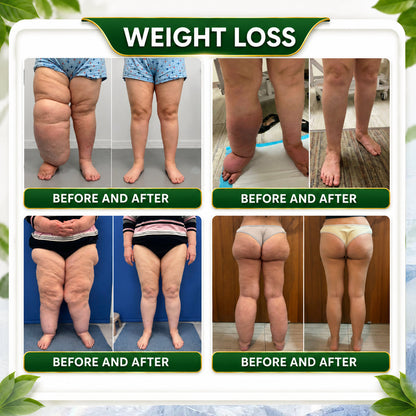 ☘️𝑮𝒓𝒆𝒆𝒏𝑭𝒆𝒆𝒍® 𝑩𝒆𝒓𝒃𝒆𝒓𝒊𝒏𝒆 𝑴𝒐𝒓𝒊𝒏𝒈𝒂- 𝑩𝒆𝒆 𝑽𝒆𝒏𝒐𝒎 𝑫𝒆𝒕𝒐𝒙 𝑺𝒍𝒊𝒎𝒎𝒊𝒏𝒈 𝑭𝒐𝒐𝒕 𝑺𝒐𝒂𝒌 𝑩𝒆𝒂𝒅 𝑺𝒖𝒑𝒑𝒐𝒓𝒕𝒔 𝑾𝒆𝒊𝒈𝒉𝒕 𝑴𝒂𝒏𝒂𝒈𝒆𝒎𝒆𝒏𝒕, 𝑳𝒚𝒎𝒑𝒉𝒂𝒕𝒊𝒄 𝑫𝒓𝒂𝒊𝒏𝒂𝒈𝒆, 𝑯𝒆𝒂𝒍𝒕𝒉𝒚 𝑪𝒊𝒓𝒄𝒖𝒍𝒂𝒕𝒊𝒐𝒏, 𝑭𝒆𝒎𝒊𝒏𝒊𝒏𝒆 𝑾𝒆𝒍𝒍𝒏𝒆𝒔𝒔 & 𝑭𝒊𝒓𝒎𝒆𝒓-𝑳𝒐𝒐𝒌𝒊𝒏𝒈 𝑺𝒌𝒊𝒏🔥