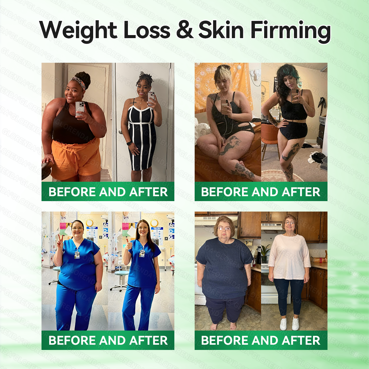 𝑶𝒇𝒇𝒊𝒄𝒊𝒂𝒍 𝑺𝒕𝒐𝒓𝒆  |🍀🍀𝐂𝐚𝐫𝐞𝐔𝐩𝐥𝐢𝐟𝐭® 𝑴𝒆𝒕𝒂𝒃𝒐𝒍𝒊𝒄 𝑵𝒂𝒏𝒐 𝑴𝒊𝒄𝒓𝒐𝒏𝒆𝒆𝒅𝒍𝒆 𝑷𝒂𝒕𝒄𝒉🇺🇸(𝐉𝐮𝐬𝐭 𝐨𝐧𝐜𝐞 𝐚 𝐝𝐚𝐲）𝘽𝙚𝙧𝙗𝙚𝙧𝙞𝙣𝙚 + 𝙈𝙤𝙧𝙞𝙣𝙜𝙖 𝙁𝙤𝙧𝙢𝙪𝙡𝙖 ✅ 𝐅𝐨𝐫 𝐨𝐛𝐞𝐬𝐢𝐭𝐲, 𝗟𝗼𝗼𝘀𝗲 𝘀𝗸𝗶𝗻,𝐝𝐢𝐚𝐛𝐞𝐭𝐞𝐬, 𝐬𝐥𝐞𝐞𝐩 𝐚𝐩𝐧𝐞𝐚, 𝐣𝐨𝐢𝐧𝐭 𝐢𝐬𝐬𝐮𝐞𝐬, 𝐚𝐧𝐝 𝐦𝐨𝐫𝐞💯
