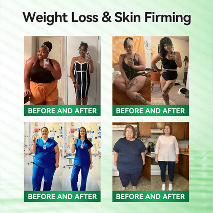 𝑶𝒇𝒇𝒊𝒄𝒊𝒂𝒍 𝑺𝒕𝒐𝒓𝒆  |🍀🍀𝐂𝐚𝐫𝐞𝐔𝐩𝐥𝐢𝐟𝐭® 𝑴𝒆𝒕𝒂𝒃𝒐𝒍𝒊𝒄 𝑵𝒂𝒏𝒐 𝑴𝒊𝒄𝒓𝒐𝒏𝒆𝒆𝒅𝒍𝒆 𝑷𝒂𝒕𝒄𝒉🇺🇸(𝐉𝐮𝐬𝐭 𝐨𝐧𝐜𝐞 𝐚 𝐝𝐚𝐲）𝘽𝙚𝙧𝙗𝙚𝙧𝙞𝙣𝙚 + 𝙈𝙤𝙧𝙞𝙣𝙜𝙖 𝙁𝙤𝙧𝙢𝙪𝙡𝙖 ✅ 𝐅𝐨𝐫 𝐨𝐛𝐞𝐬𝐢𝐭𝐲, 𝗟𝗼𝗼𝘀𝗲 𝘀𝗸𝗶𝗻,𝐝𝐢𝐚𝐛𝐞𝐭𝐞𝐬, 𝐬𝐥𝐞𝐞𝐩 𝐚𝐩𝐧𝐞𝐚, 𝐣𝐨𝐢𝐧𝐭 𝐢𝐬𝐬𝐮𝐞𝐬, 𝐚𝐧𝐝 𝐦𝐨𝐫𝐞💯
