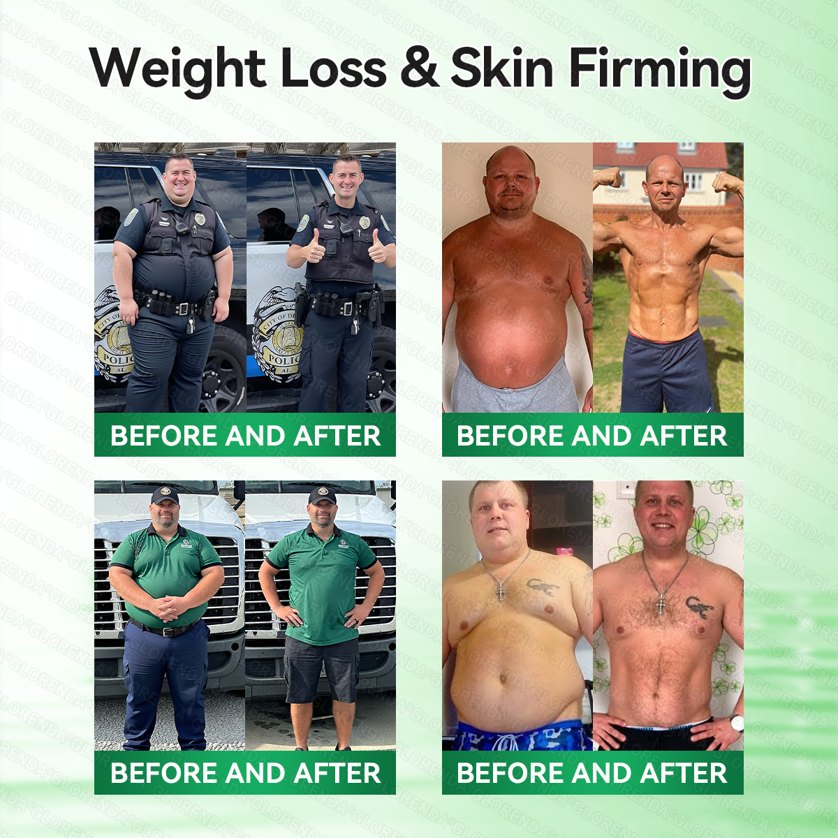 𝑶𝒇𝒇𝒊𝒄𝒊𝒂𝒍 𝑺𝒕𝒐𝒓𝒆  |🍀🍀𝐂𝐚𝐫𝐞𝐔𝐩𝐥𝐢𝐟𝐭® 𝑴𝒆𝒕𝒂𝒃𝒐𝒍𝒊𝒄 𝑵𝒂𝒏𝒐 𝑴𝒊𝒄𝒓𝒐𝒏𝒆𝒆𝒅𝒍𝒆 𝑷𝒂𝒕𝒄𝒉🇺🇸(𝐉𝐮𝐬𝐭 𝐨𝐧𝐜𝐞 𝐚 𝐝𝐚𝐲）𝘽𝙚𝙧𝙗𝙚𝙧𝙞𝙣𝙚 + 𝙈𝙤𝙧𝙞𝙣𝙜𝙖 𝙁𝙤𝙧𝙢𝙪𝙡𝙖 ✅ 𝐅𝐨𝐫 𝐨𝐛𝐞𝐬𝐢𝐭𝐲, 𝗟𝗼𝗼𝘀𝗲 𝘀𝗸𝗶𝗻,𝐝𝐢𝐚𝐛𝐞𝐭𝐞𝐬, 𝐬𝐥𝐞𝐞𝐩 𝐚𝐩𝐧𝐞𝐚, 𝐣𝐨𝐢𝐧𝐭 𝐢𝐬𝐬𝐮𝐞𝐬, 𝐚𝐧𝐝 𝐦𝐨𝐫𝐞💯