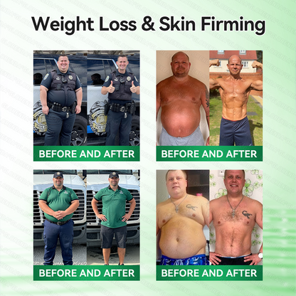 𝑶𝒇𝒇𝒊𝒄𝒊𝒂𝒍 𝑺𝒕𝒐𝒓𝒆  |🍀🍀𝐂𝐚𝐫𝐞𝐔𝐩𝐥𝐢𝐟𝐭® 𝑴𝒆𝒕𝒂𝒃𝒐𝒍𝒊𝒄 𝑵𝒂𝒏𝒐 𝑴𝒊𝒄𝒓𝒐𝒏𝒆𝒆𝒅𝒍𝒆 𝑷𝒂𝒕𝒄𝒉🇺🇸(𝐉𝐮𝐬𝐭 𝐨𝐧𝐜𝐞 𝐚 𝐝𝐚𝐲）𝘽𝙚𝙧𝙗𝙚𝙧𝙞𝙣𝙚 + 𝙈𝙤𝙧𝙞𝙣𝙜𝙖 𝙁𝙤𝙧𝙢𝙪𝙡𝙖 ✅ 𝐅𝐨𝐫 𝐨𝐛𝐞𝐬𝐢𝐭𝐲, 𝗟𝗼𝗼𝘀𝗲 𝘀𝗸𝗶𝗻,𝐝𝐢𝐚𝐛𝐞𝐭𝐞𝐬, 𝐬𝐥𝐞𝐞𝐩 𝐚𝐩𝐧𝐞𝐚, 𝐣𝐨𝐢𝐧𝐭 𝐢𝐬𝐬𝐮𝐞𝐬, 𝐚𝐧𝐝 𝐦𝐨𝐫𝐞💯